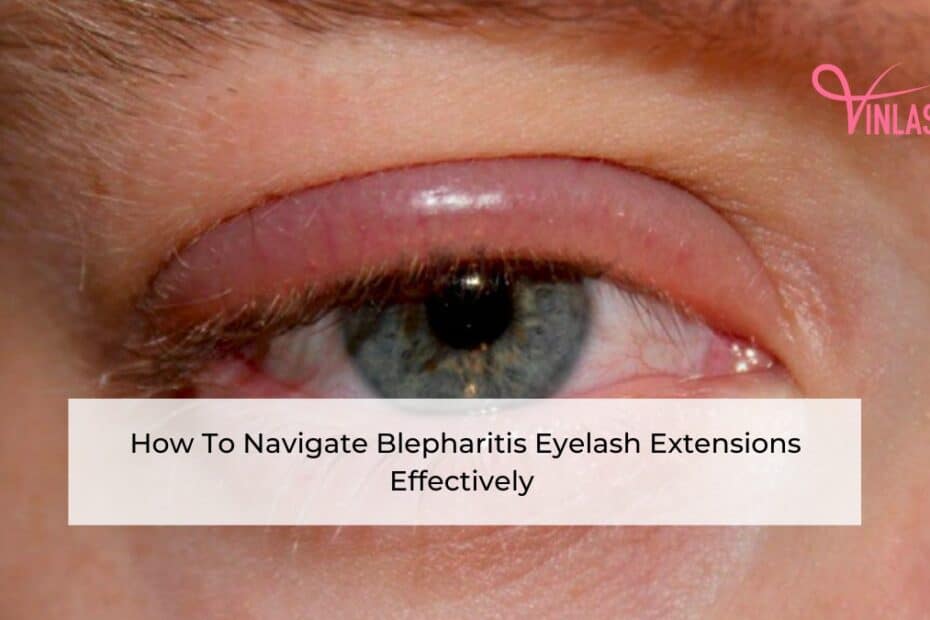 how-to-navigate-blepharitis-eyelash-extensions-effectively