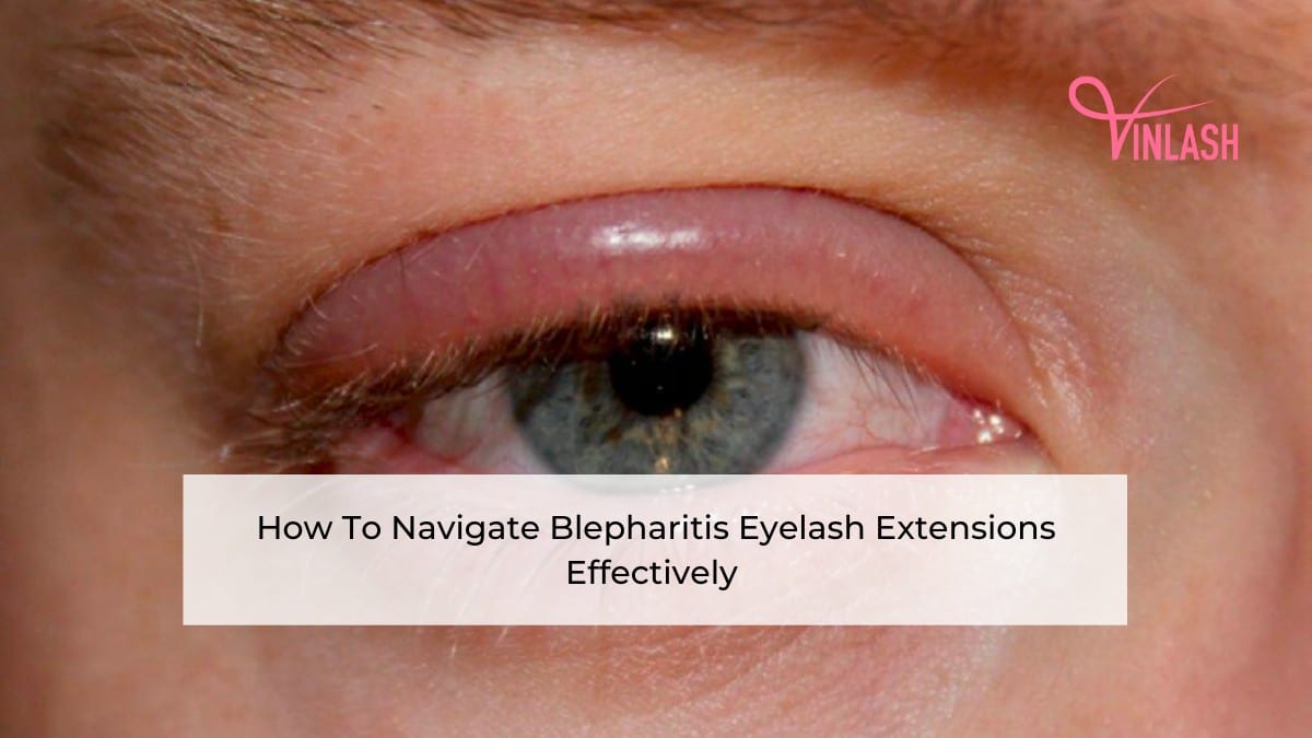 how-to-navigate-blepharitis-eyelash-extensions-effectively