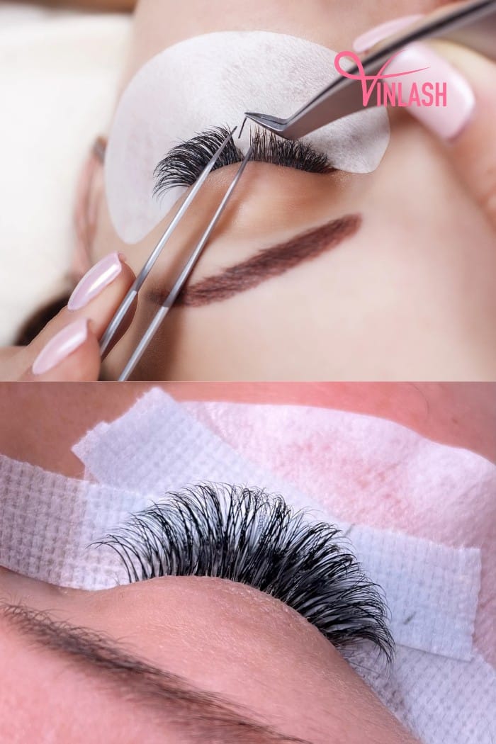 The right application technique is essential in preventing chemical burns during eyelash extension procedures