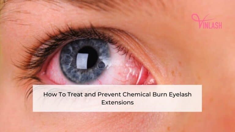 how-to-treat-and-prevent-chemical-burn-eyelash-extensions