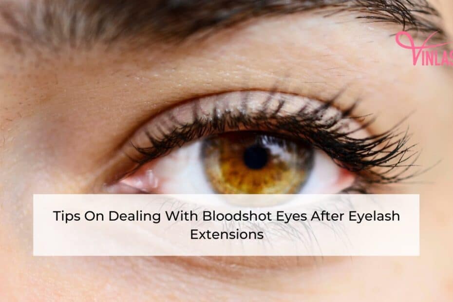tips-on-dealing-with-bloodshot-eyes-after-eyelash-extensions