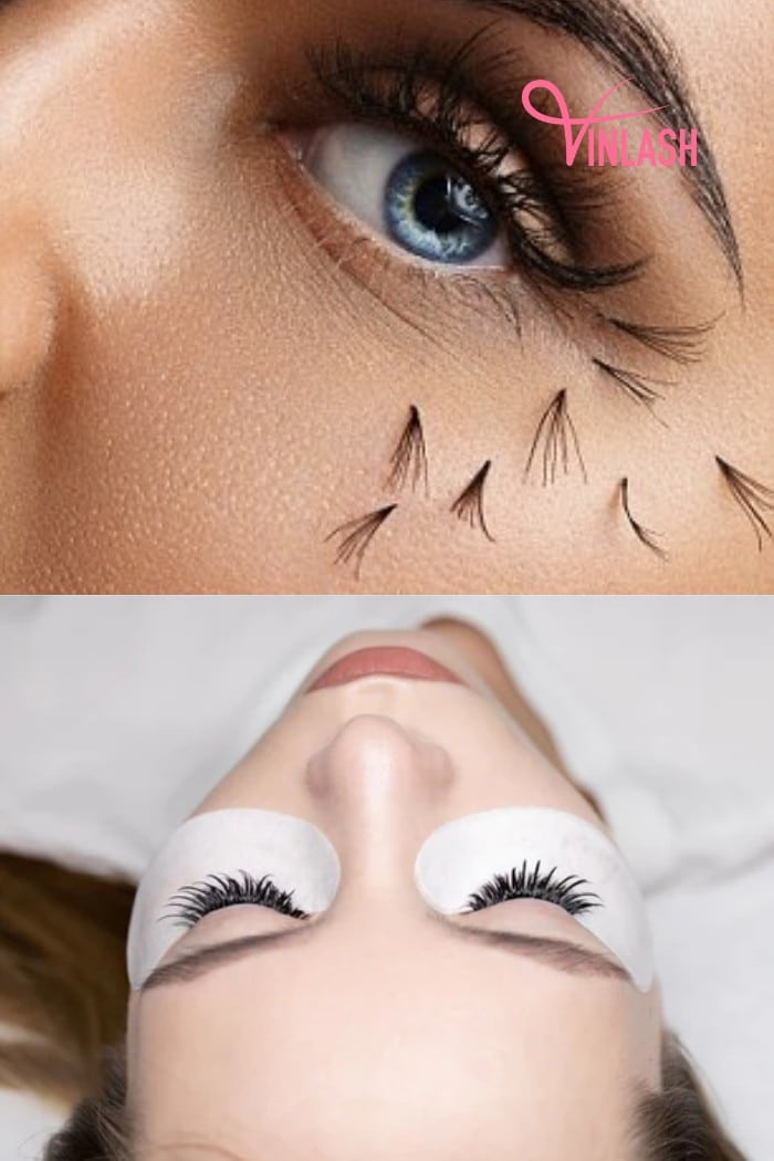 Allergic reactions to lash materials or adhesives can adversely affect lash retention
