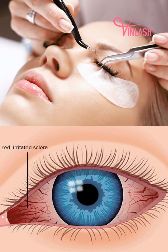 choosing-eyelash-extensions-for-sensitive-eyes-and-aftercare-2